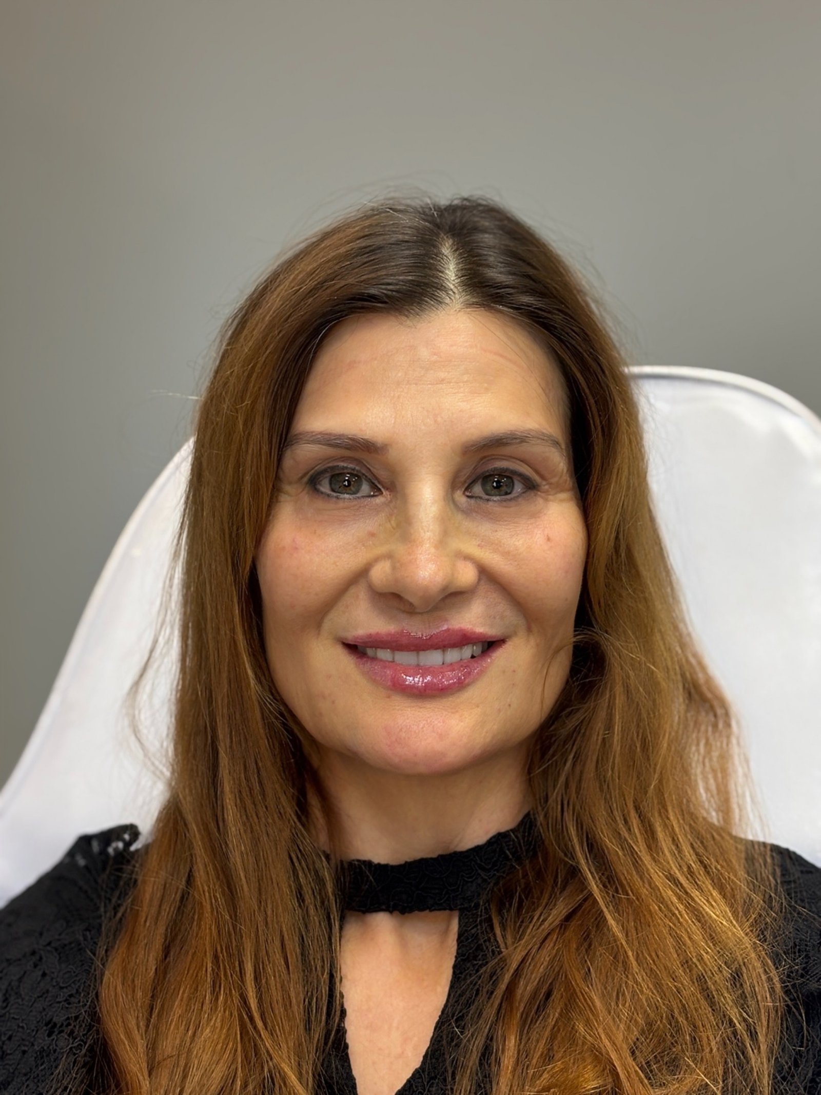 Avaliação facial para harmonização e preenchimento